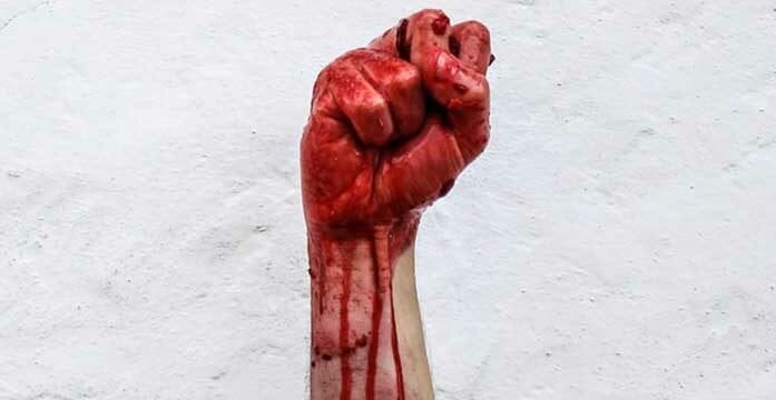 War bloody fist We need to fight back against Communist China’s bullying