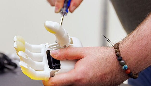 AI is revolutionizing prosthetics